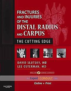 Fractures and Injuries of the Distal Radius and Carpus