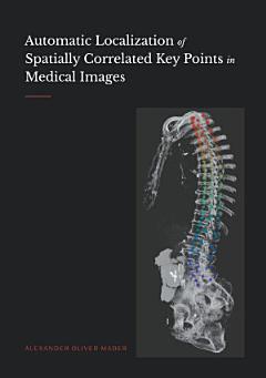 Automatic Localization of Spatially Correlated Key Points in Medical Images