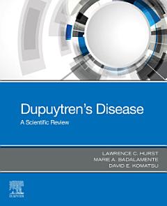 Dupuytren\'s Disease - E-BOOK