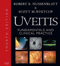 Uveitis E-Book