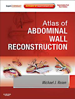 Atlas of Abdominal Wall Reconstruction E-Book