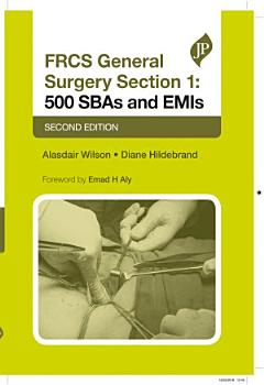 FRCS General Surgery Section 1: 500 SBAs and EMIs