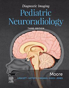 Diagnostic Imaging: Pediatric Neuroradiology E-Book