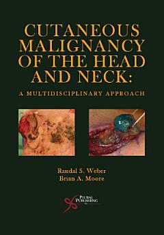 Cutaneous Malignancy of the Head and Neck