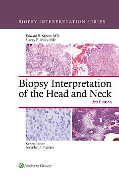 Biopsy Interpretation of the Head and Neck