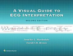 A Visual Guide to ECG Interpretation