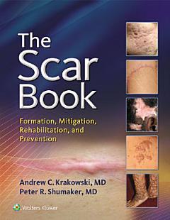 The Scar Book