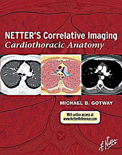 Netter\'s Correlative Imaging: Cardiothoracic Anatomy