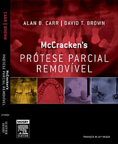 Mccracken Prótese Parcial Removível