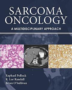 Sarcoma Oncology