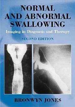 Normal and Abnormal Swallowing