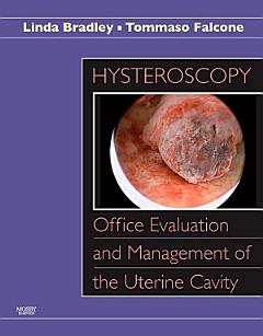 Hysteroscopy: Office Evaluation and Management of the Uterine Cavity E-Book