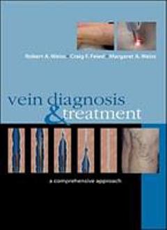 Vein Diagnosis & Treatment: A Comprehensive Approach