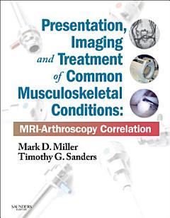 Presentation, Imaging and Treatment of Common Musculoskeletal Conditions E-Book