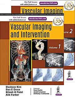 Vascular Imaging and Intervention