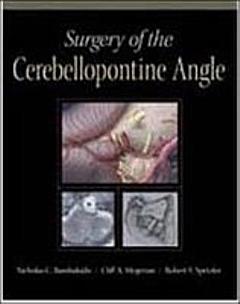 Surgery of the Cerebellopontine Angle