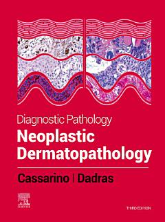 Diagnostic Pathology: Neoplastic Dermatopathology E-Book