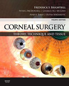 Corneal Surgery E-Book