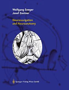 Neuronavigation and Neuroanatomy