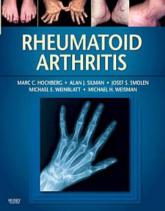 Rheumatoid Arthritis E-Book