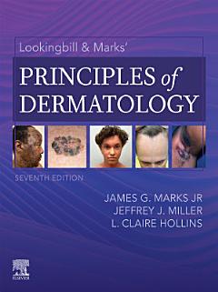 Lookingbill and Marks\' Principles of Dermatology - E-Book