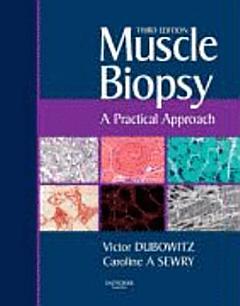 Muscle Biopsy