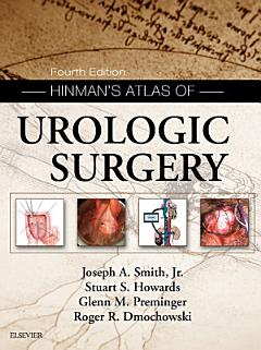 Hinman\'s Atlas of Urologic Surgery E-Book