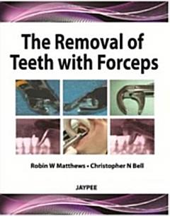 The Removal of Teeth with Forceps