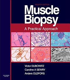 Muscle Biopsy E-Book