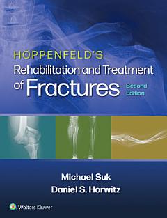 Hoppenfeld\'s Treatment and Rehabilitation of Fractures