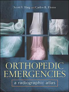 Orthopedic Emergencies