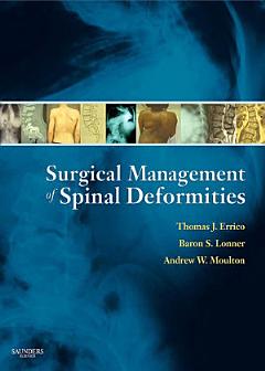 Surgical Management of Spinal Deformities E-Book