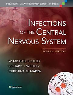 Infections of the Central Nervous System