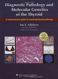 Diagnostic Pathology and Molecular Genetics of the Thyroid