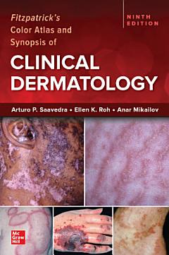 Fitzpatrick\'s Color Atlas and Synopsis of Clinical Dermatology, 9/e