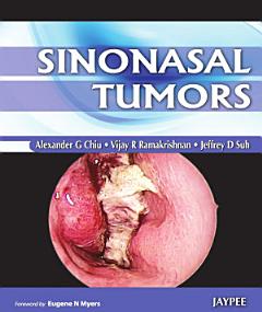 Sinonasal Tumors