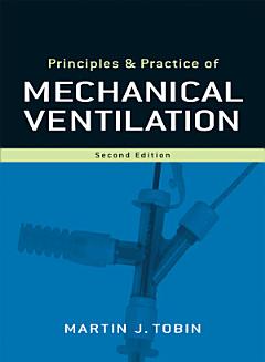 Principles and Practice of Mechanical Ventilation