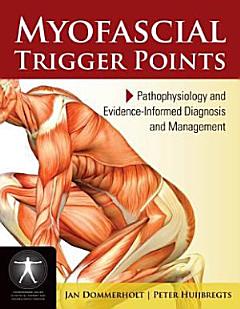 Myofascial Trigger Points