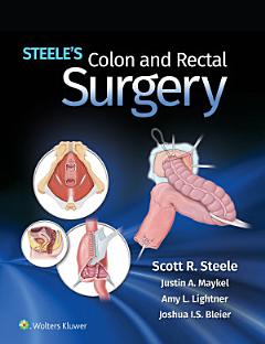 Steele\'s Colon and Rectal Surgery