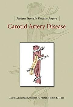 Carotid Artery Disease