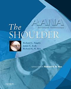 AANA Advanced Arthroscopy: The Shoulder E-Book