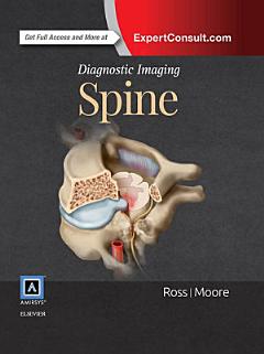 Diagnostic Imaging: Spine