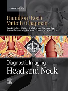 Diagnostic Imaging: Head and Neck - E-Book