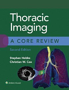 Thoracic Imaging: A Core Review