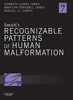 Smith\'s Recognizable Patterns of Human Malformation