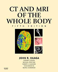 Computed Tomography & Magnetic Resonance Imaging Of The Whole Body E-Book