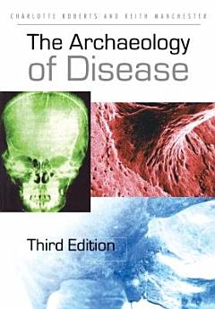 The Archaeology of Disease