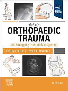 McRae\'s Orthopaedic Trauma and Emergency Fracture Management E-Book