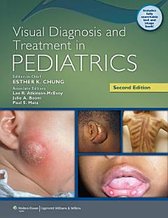 Visual Diagnosis and Treatment in Pediatrics