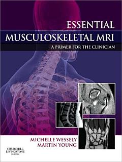 Essential Musculoskeletal MRI E-Book